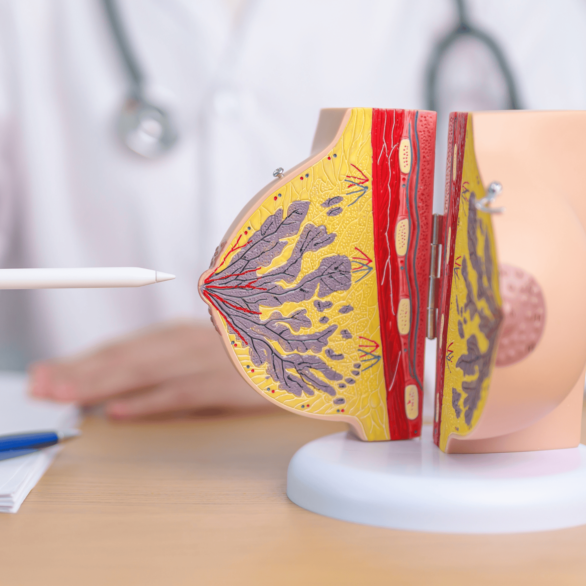 Teste Genético Revolucionário: Câncer de Mama em Estágio Inicial Pode Dispensar Quimioterapia para Milhares