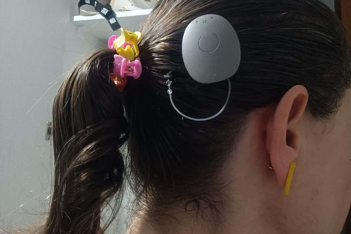 Paraná assume liderança nacional em implantes de correção auditiva pelo SUS - Conselho Nacional de Secretários de Saúde